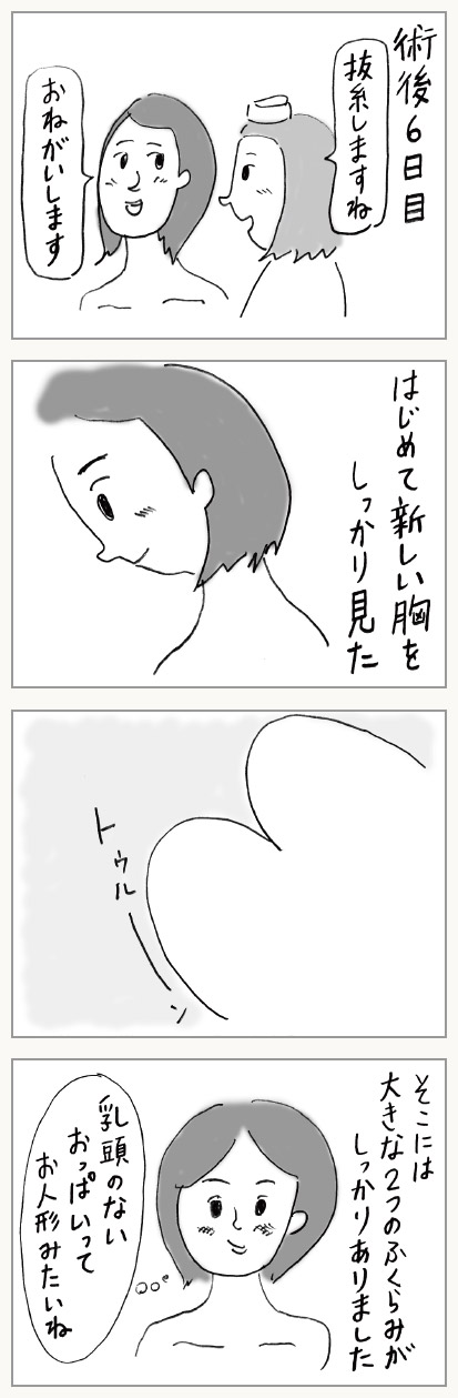 第6話「新しくなった自分の胸をはじめて見た」