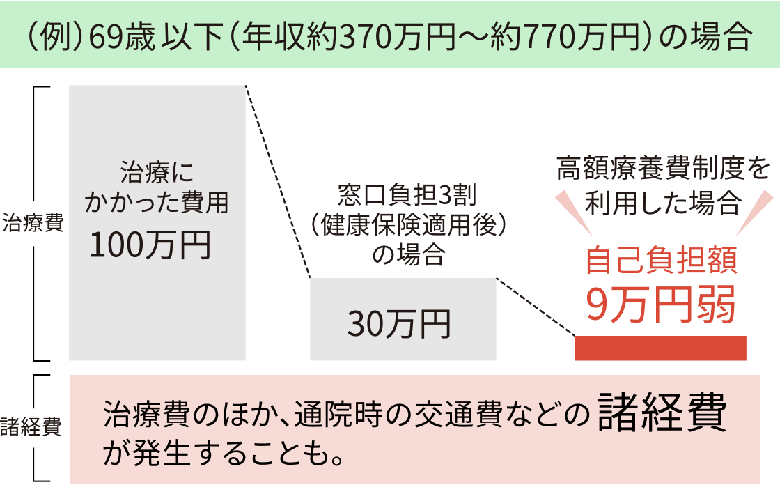 （例）69歳以下（年収約370万円〜約770万円）の場合 治療にかかった費用100万円 窓口負担3割（健康保険適用後）の場合30万円 高額療養費制度を利用した場合 自己負担額9万円弱 治療費 諸経費 治療費のほか通院時の交通費などの諸経費が発生することも